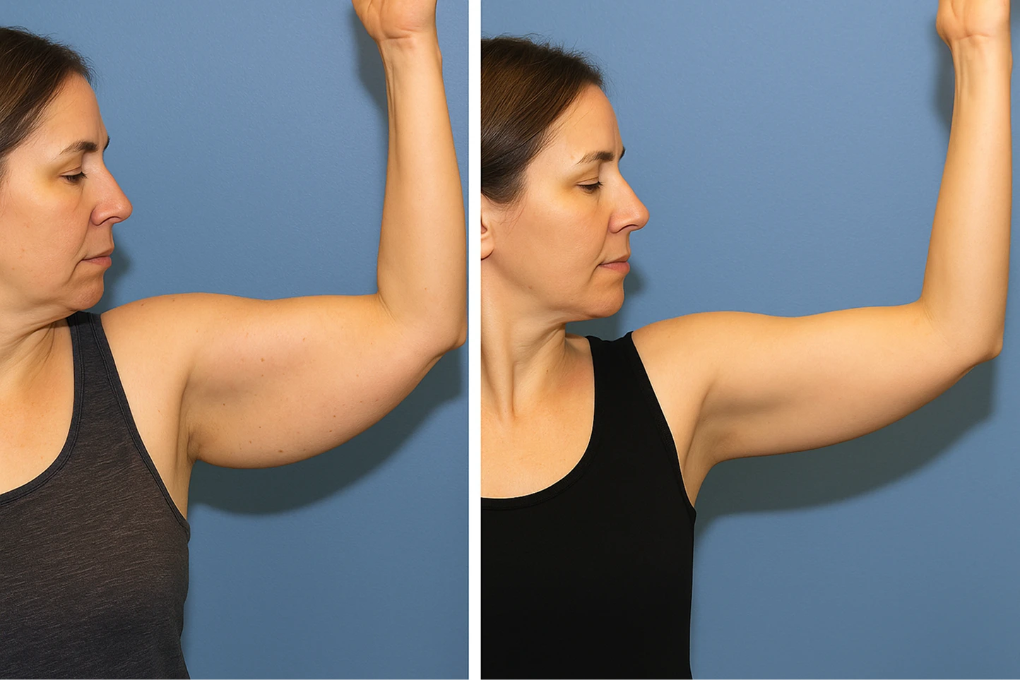 Sıkılaştırıcı Masaj Aleti